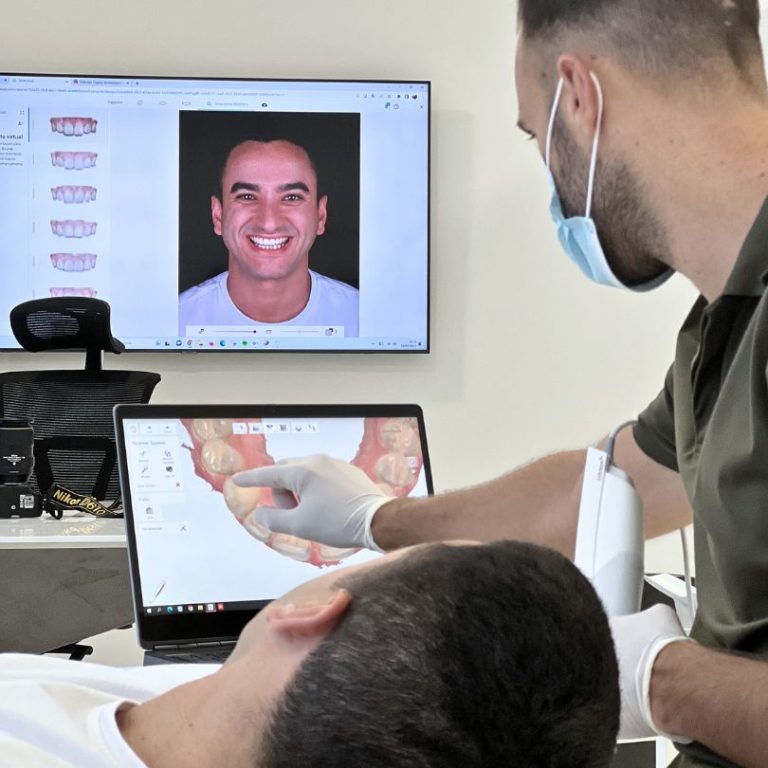 Escáner intraoral de última generación en Smile Studio
